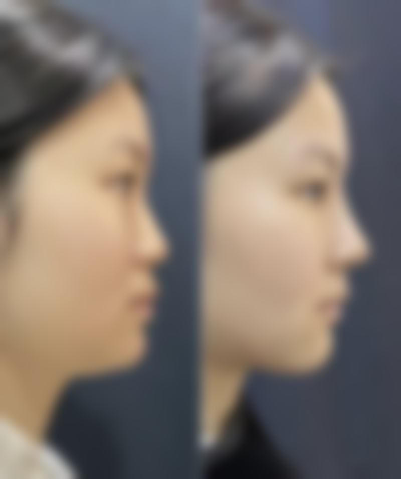 何展宏擅长项目列表