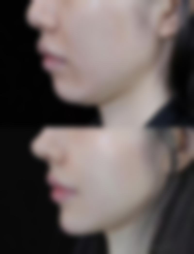 北京普蕊丰亭丰晓冰医疗美容诊所患者评价