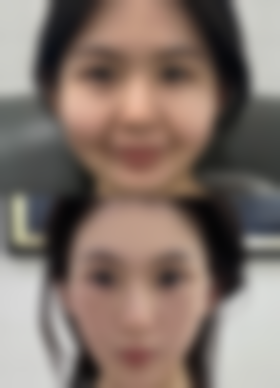 湘潭雨湖张晓鸿整形诊所价格参考