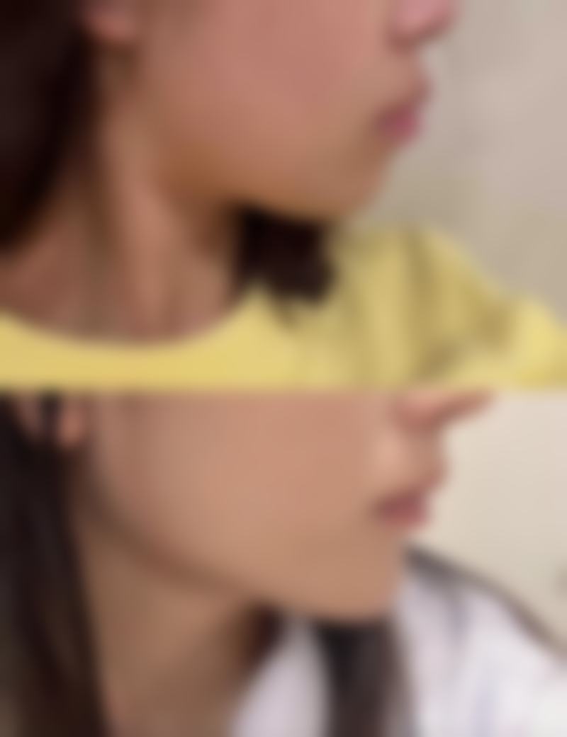 韩国美佳整形美容医院交通路线与预约