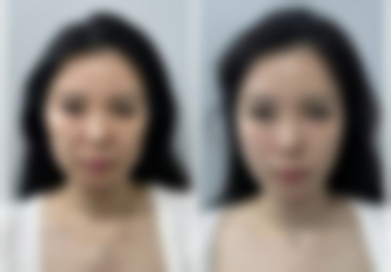 北京普蕊丰亭丰晓冰医疗美容诊所正规资质