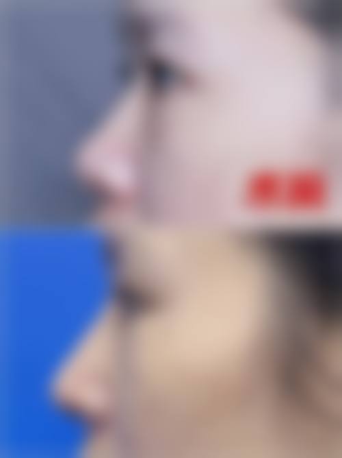 柳熙重技术水平评价