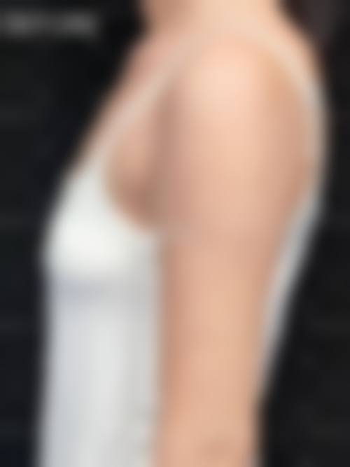 重庆爱美整形医院患者评价