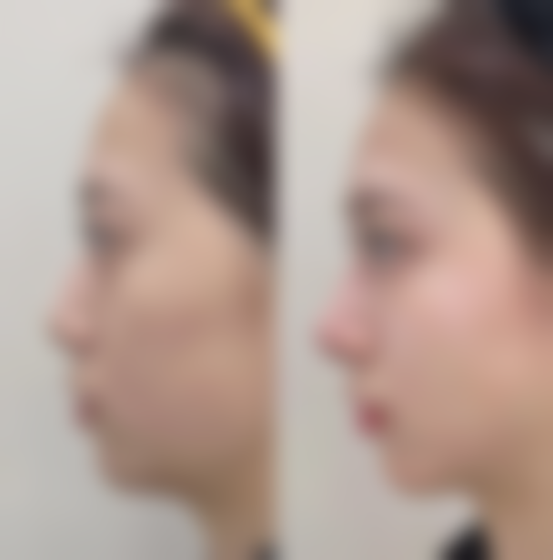 朴埈亨患者评价