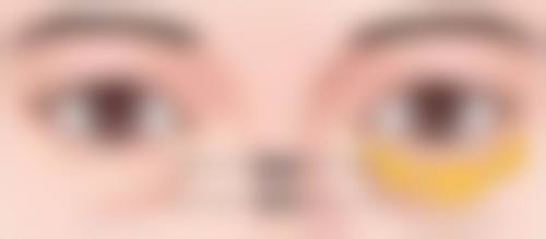 聊城东昌府区美莱雅医疗美容诊所患者评价