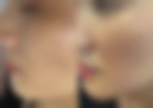 金秀敬患者评价