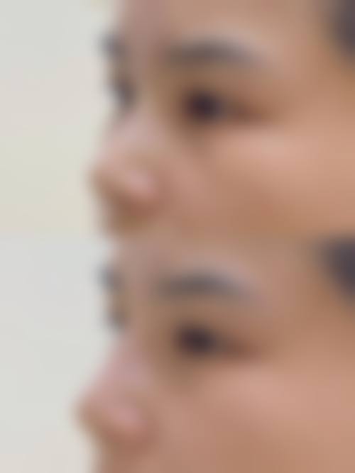 慈溪玛丽医院整形美容中 心正规资质