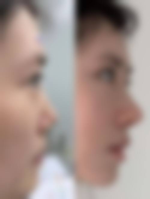 慈溪玛丽医院整形美容中 心核心项目