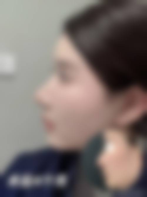 慈溪玛丽医院整形美容中 心价格参考