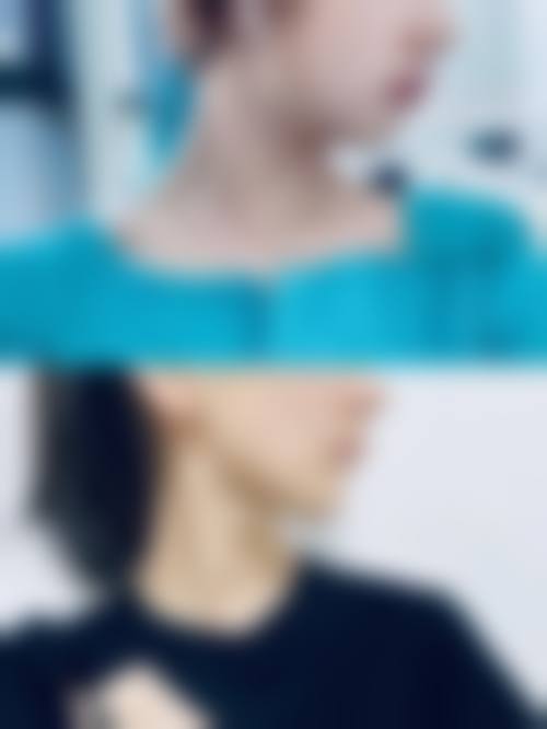 昆明悦格医疗美容核心项目