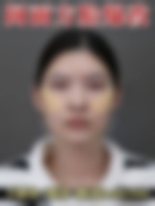 昆明悦格医疗美容患者评价