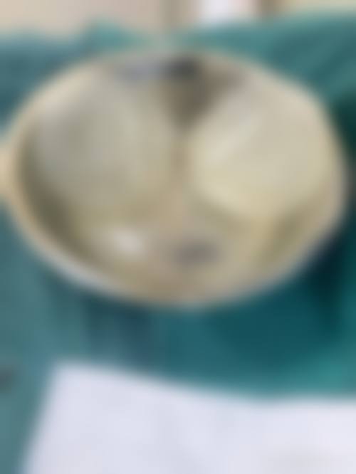 青岛卓颜医疗美容患者评价