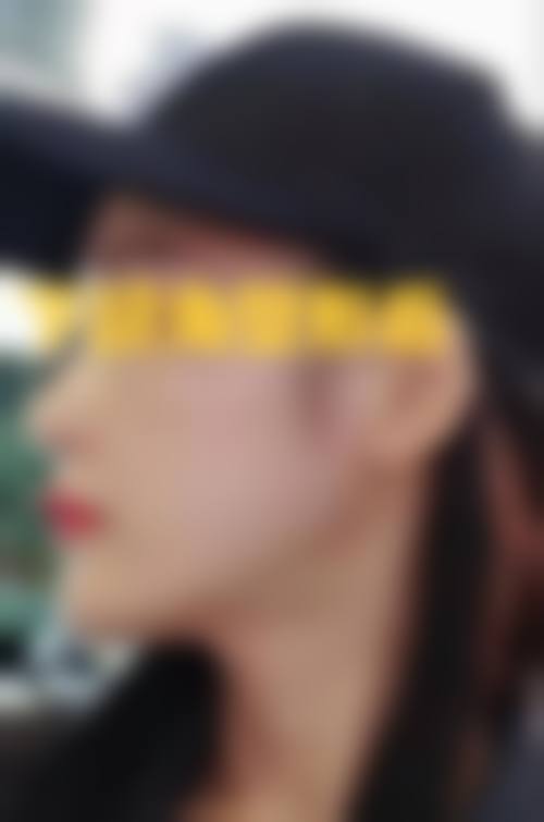 乌海悦己悦心医疗美容诊所核心项目