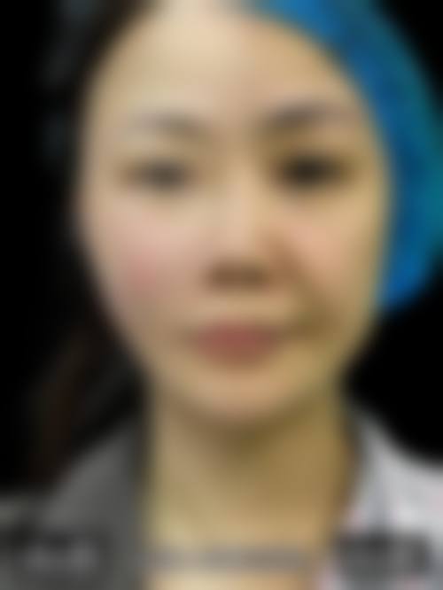 北京善之美医疗美容医院价格参考