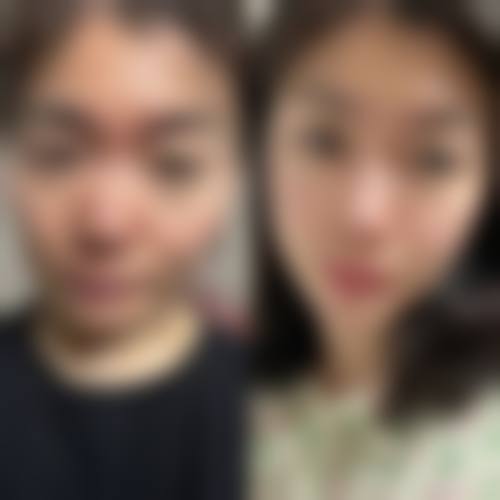 北京善之美医疗美容医院患者评价