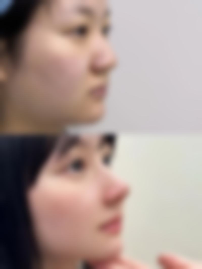 柳熙重预约方式