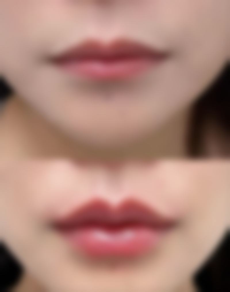 聊城东昌府区美莱雅医疗美容诊所交通路线与预约