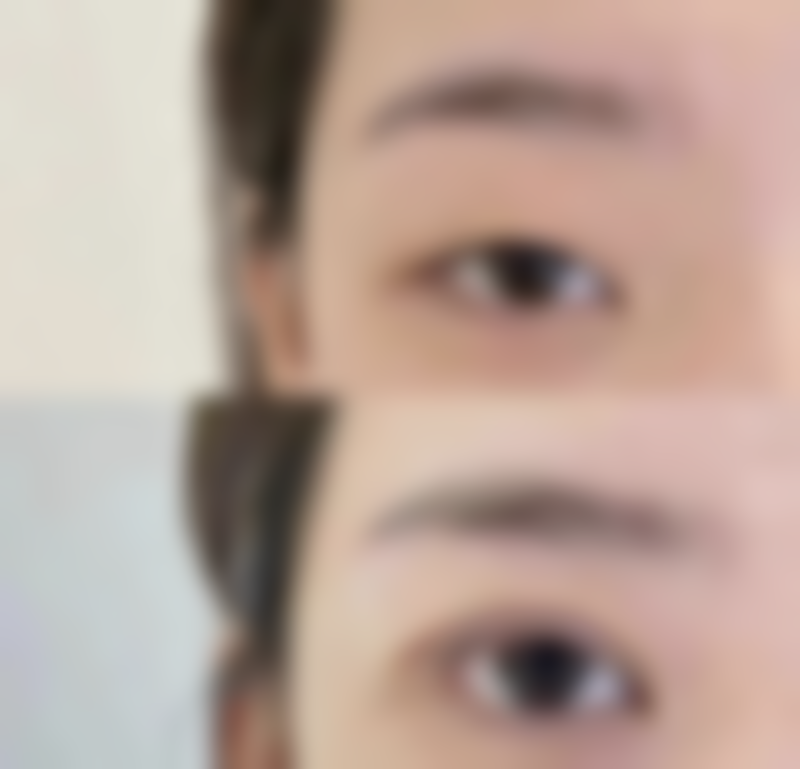 宁波颜植术医疗美容诊所患者评价