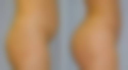 柳熙重预约方式