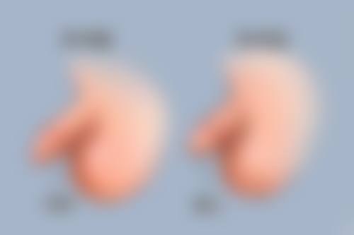 （私密科）威海东大医院交通路线与预约