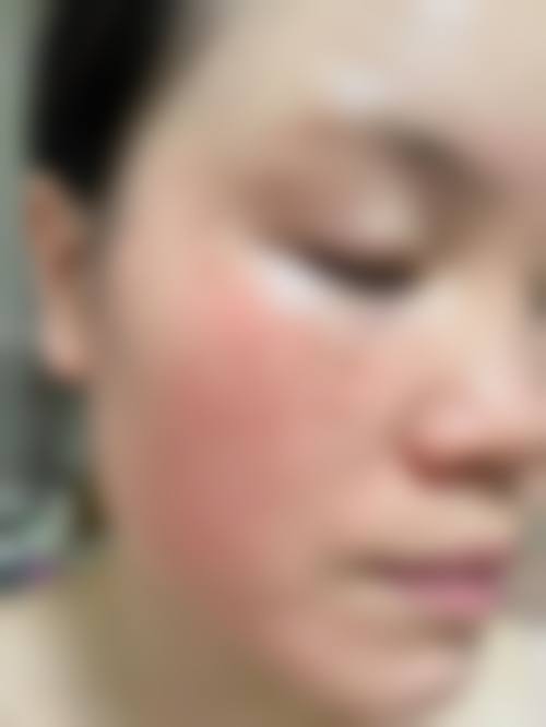 陈玉琼预约方式