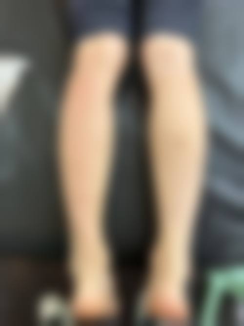 陈玉琼擅长项目列表