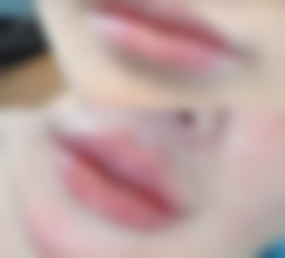 海口盛千医美整形医院价格参考