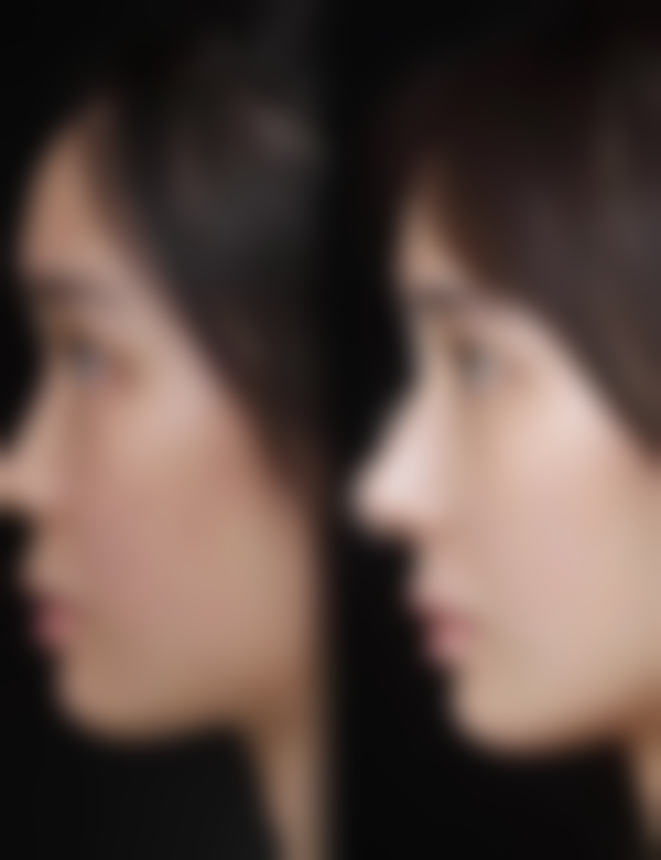 朴埈亨擅长项目列表