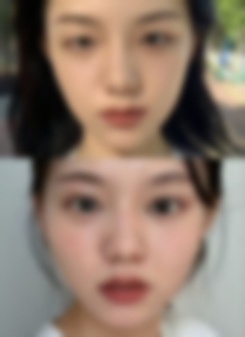 海口盛千医美整形医院患者评价