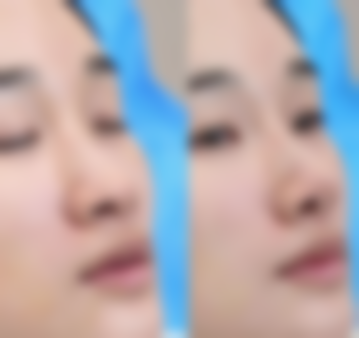 金鉉哲预约方式