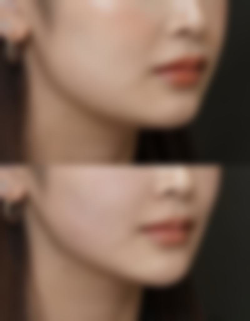 内江维多利整形医院价格参考