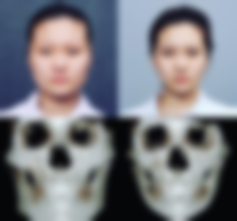 太原赫拉医疗美容整形患者评价