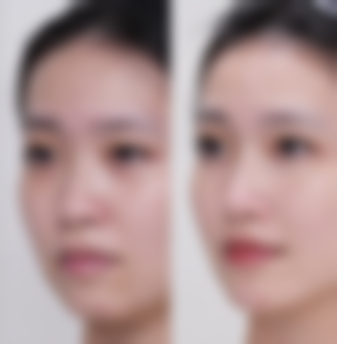 淄博妆典医疗整形美容价格参考