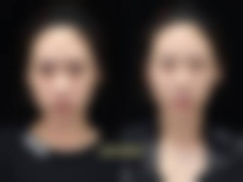 禹政浩预约方式及价格表