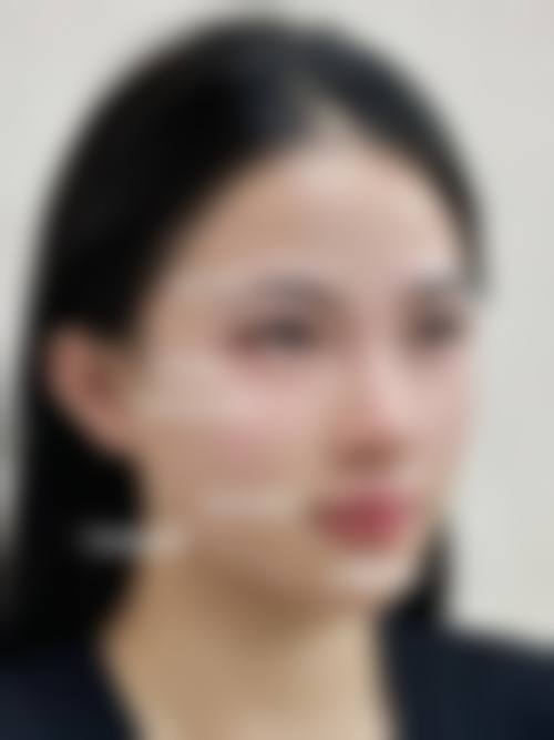 陈玉琼擅长项目列表