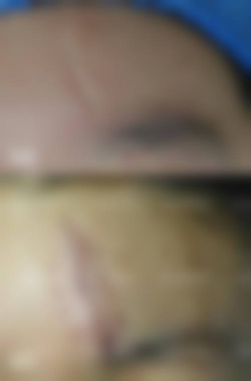 无锡同舟整形医院患者评价