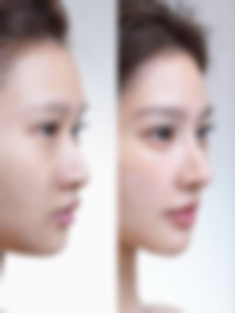 黄雨预约方式及价格表