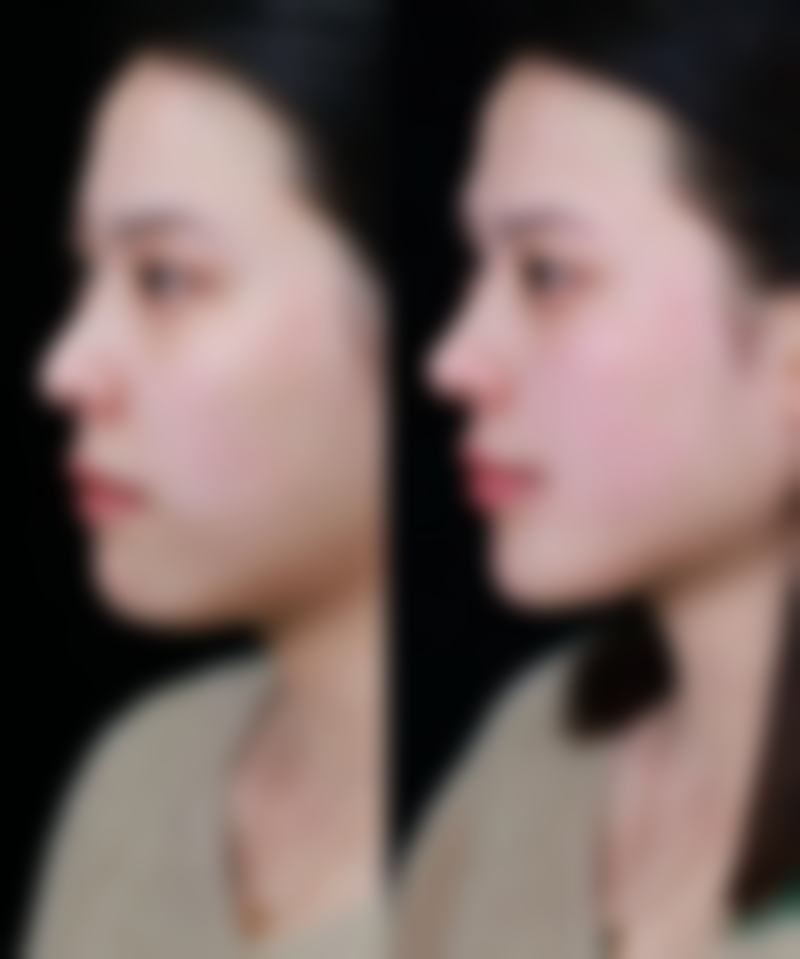 济南悦美医疗美容价格参考