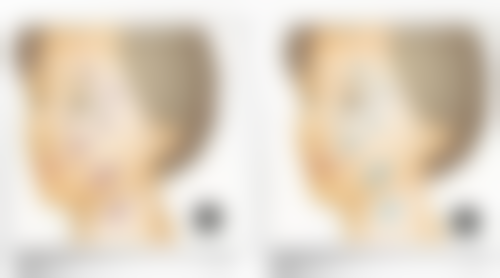 北京曙光医院医疗美容科价格参考