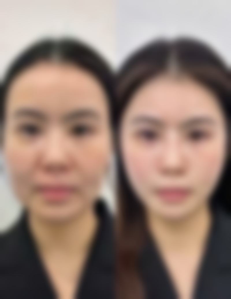 重庆美颜臣医疗美容医院核心项目