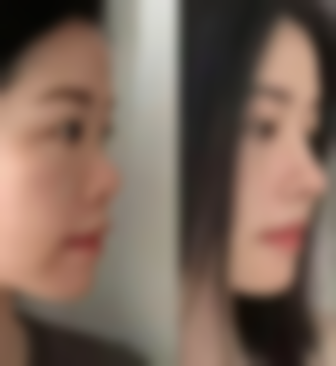 长沙贝美整形医疗美容医院患者评价