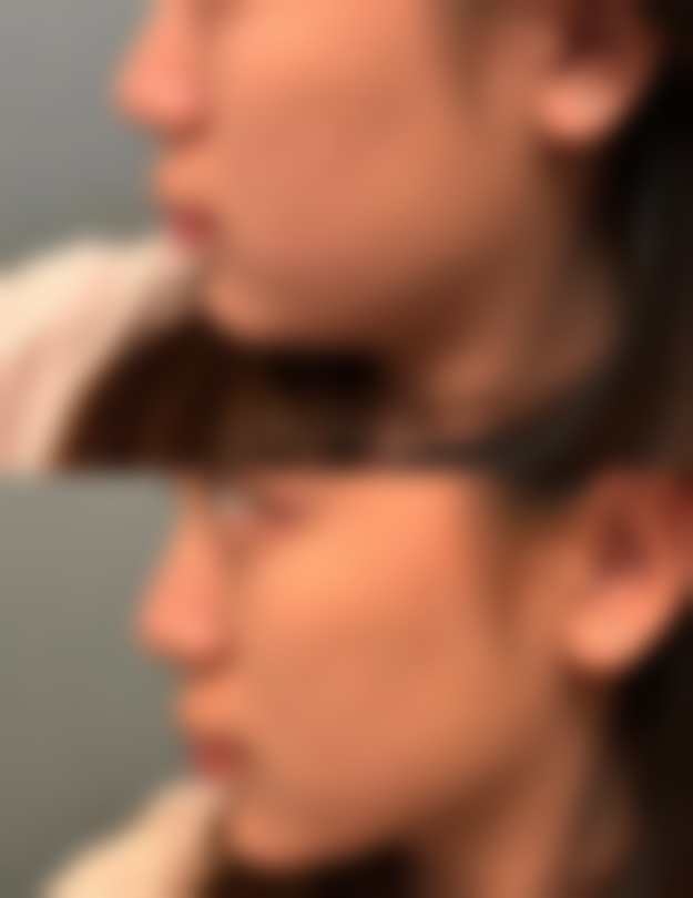 黄雨技术水平评价