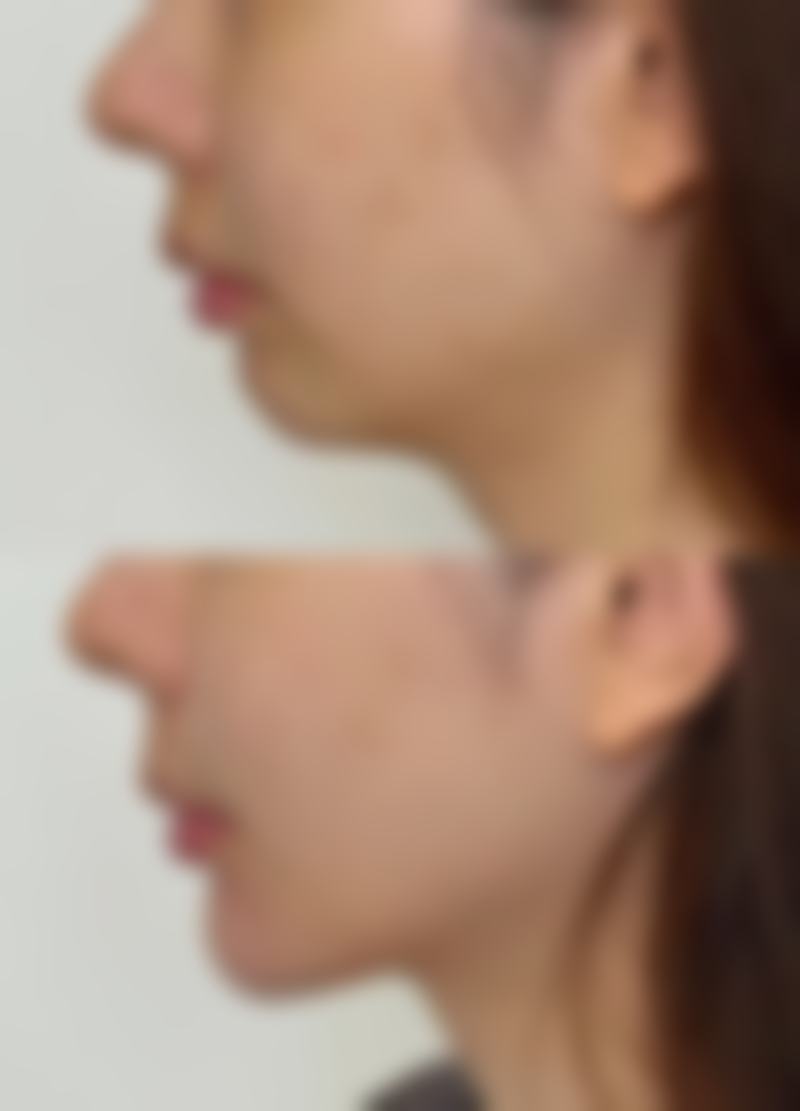 合肥未莱医疗美容医院正规资质