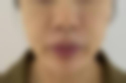 吴明埈患者评价