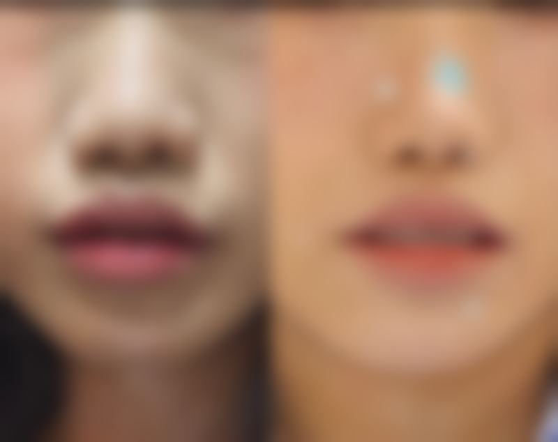 韩国美佳整形美容医院地址及到院路线