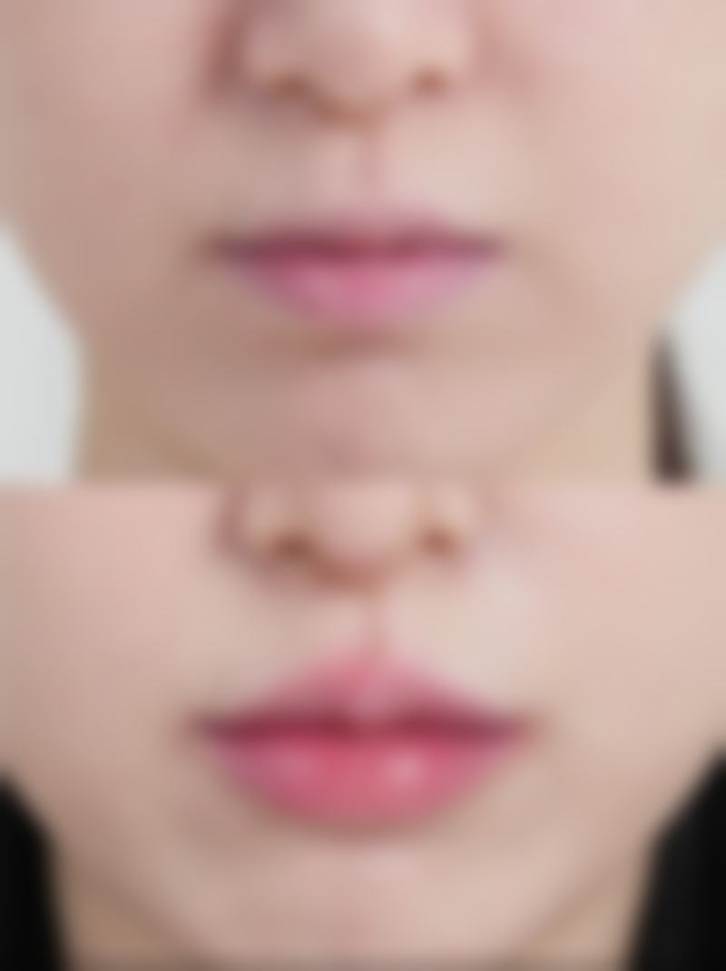 广西柳钢医院烧伤整形科核心项目