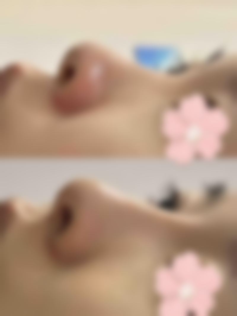 南宁瑞小美万象汇整形医院患者评价