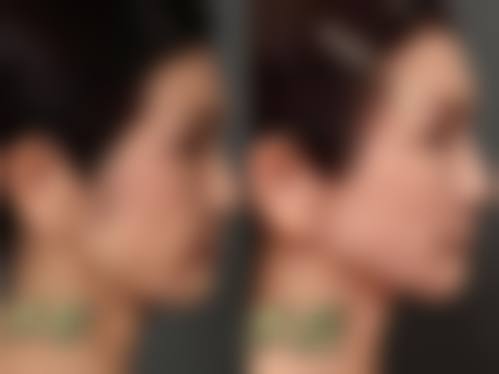 青岛韩佳人医疗美容门诊部交通路线与预约