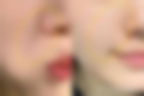 佛山医博士整形美容门诊部核心项目