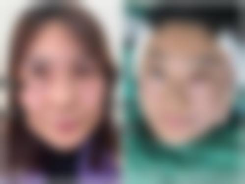 佛山医博士整形美容门诊部正规资质